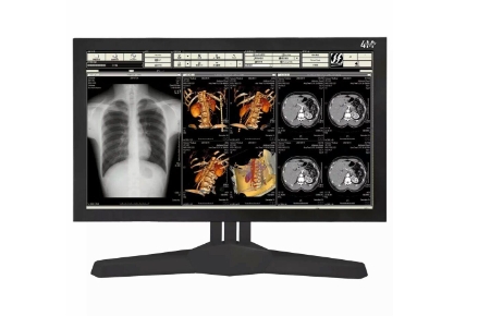 1710903310197725.png 醫(yī)療顯示器.png