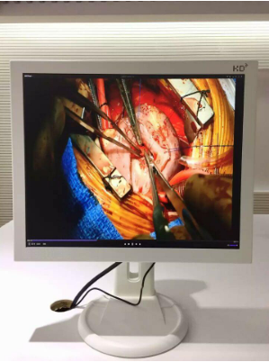 4寸觸摸屏在健康醫(yī)療行業(yè)的運用